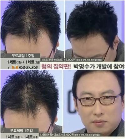 정전기 딜 사이클