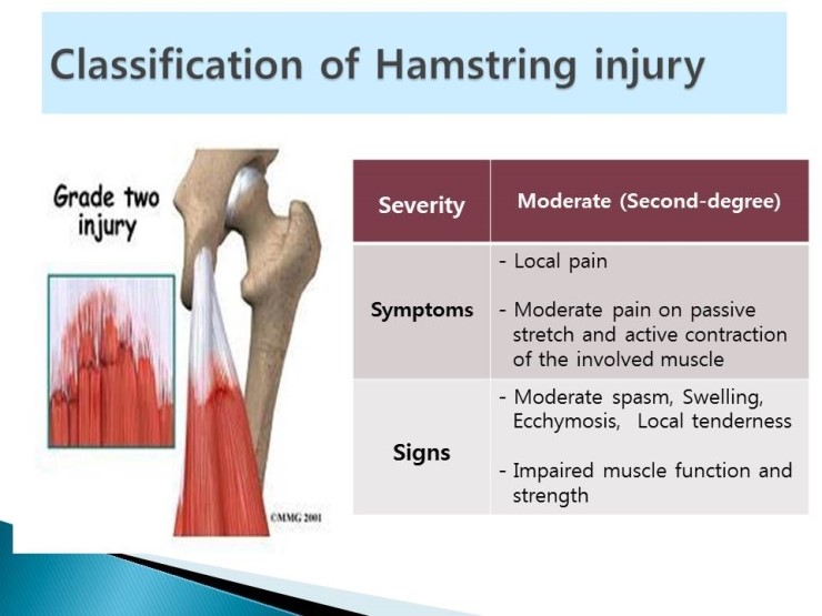 햄스트링 손상(hamstring tear) 기전 및 재활운동치료 네이버 블로그